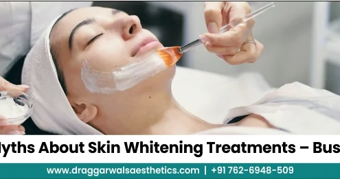 Skin Whitening Treatment Myth Busted