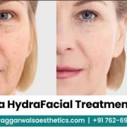 HydraFacial Treatment: Dos and Don’ts