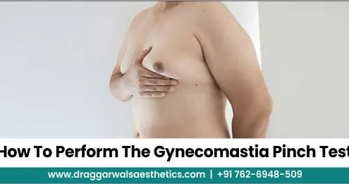 gynecomastia pinch test 2025 guide